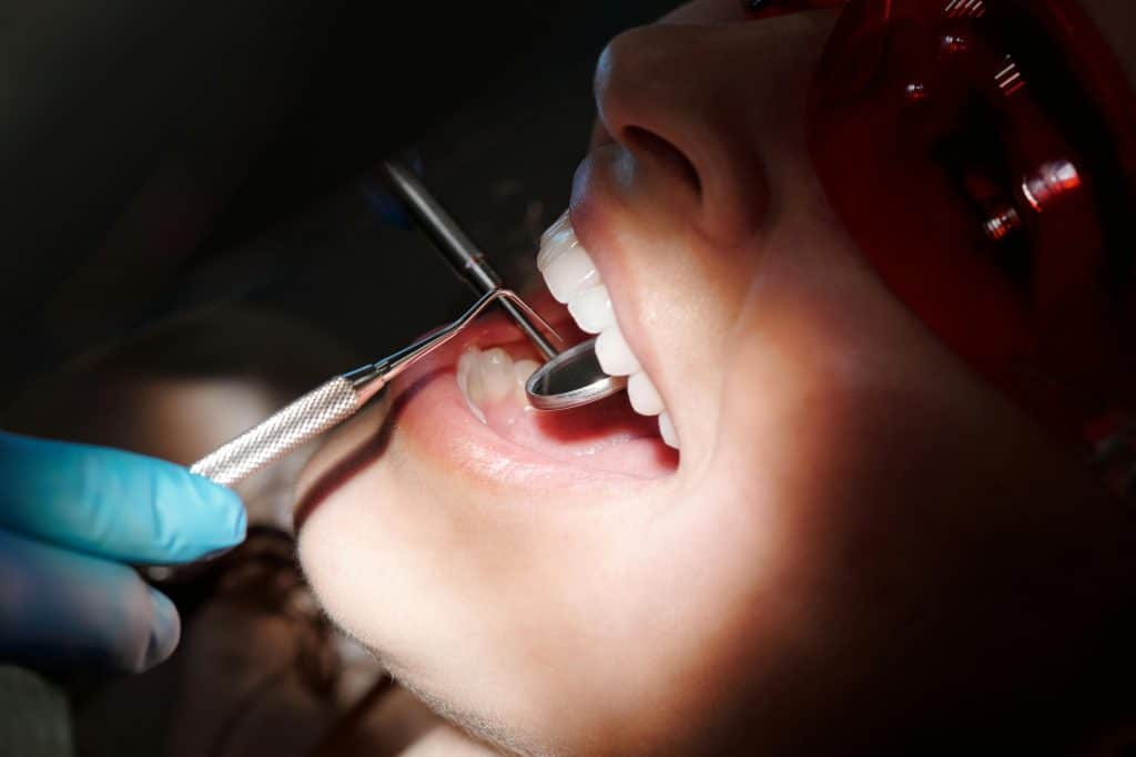 Macchiette bianche sui denti: la loro comparsa è una situazione abbastanza frequente. Esistono vari rimedi, scoprili in questo articolo.